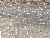 Transversal section